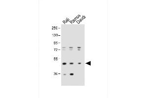 All lanes : Anti-IGHE Antibody (Center) at 1:1000 dilution Lane 1: Raji whole cell lysate Lane 2: Ramos whole cell lysate Lane 3:Daudi whole cell lysate Lysates/proteins at 20 μg per lane. (IgE Antikörper  (AA 246-275))