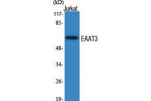 Western Blot (WB) analysis of specific cells using EAAT3 Polyclonal Antibody. (SLC1A1 Antikörper  (Internal Region))