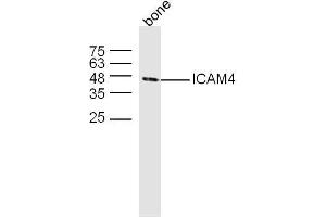 Mouse bone lysates probed with ICAM4 Polyclonal Antibody, unconjugated  at 1:300 overnight at 4°C followed by a conjugated secondary antibody at 1:10000 for 60 minutes at 37°C. (ICAM4 Antikörper  (AA 85-180))