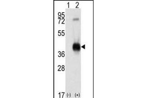 Western blot analysis of CK1 (arrow) using rabbit polyclonal CK1 Antibody (C-term) (ABIN391310 and ABIN2841344). (CAMK1 Antikörper  (C-Term))