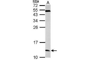 Western Blotting (WB) image for anti-Enhancer of Rudimentary Homolog (ERH) (Center) antibody (ABIN2855178)