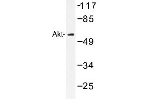 Image no. 1 for anti-V-Akt Murine Thymoma Viral Oncogene Homolog 1 (AKT1) antibody (ABIN272119) (AKT1 Antikörper)