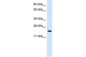 Western Blotting (WB) image for anti-High Mobility Group Box 3 (HMGB3) antibody (ABIN2461206) (HMGB3 Antikörper)
