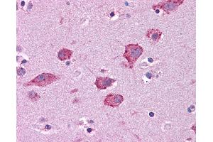 Immunohistochemistry (IHC) image for anti-Hepatocyte Growth Factor (Hepapoietin A, Scatter Factor) (HGF) (AA 216-265) antibody (ABIN604744)