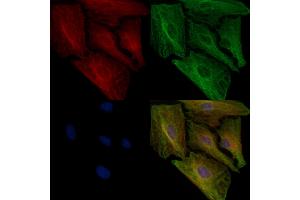 ABIN6257958 and ABIN6274924 staining  cells by IF/ICC. (BAIAP2L1 Antikörper  (Internal Region))