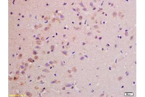 Immunohistochemistry (IHC) image for anti-NADH Dehydrogenase (Ubiquinone) Fe-S Protein 1, 75kDa (NADH-Coenzyme Q Reductase) (NDUFS1) (AA 51-150) antibody (ABIN750703)