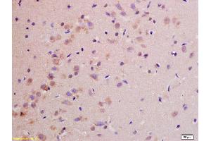 Formalin-fixed and paraffin embedded rat brain labeled with Rabbit Anti NDUFS1(75kD) Polyclonal Antibody, Unconjugated (ABIN750703) at 1:200 followed by conjugation to the secondary antibody and DAB staining (NDUFS1 Antikörper  (AA 51-150))