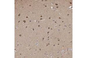 Immunohistochemical staining of human cerebral cortex with PLCH1 polyclonal antibody  shows moderate cytoplasmic positivity in neuronal cells. (PLCH1 Antikörper)