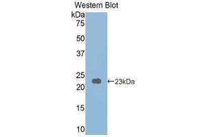 Western Blotting (WB) image for phosphorylase, Glycogen, Liver (PYGL) ELISA Kit (ABIN6574226)