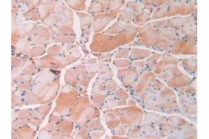IHC-P analysis of Mouse Skeletal Muscle Tissue, with DAB staining.