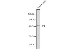 FYB Antikörper  (AA 678-829)