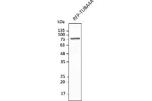Western Blotting (WB) image for anti-tdTomato Fluorescent Protein (tdTomato) antibody (DyLight 550) (ABIN7273113) (tdTomato Antikörper  (DyLight 550))