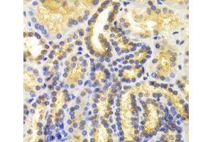 Immunohistochemistry of paraffin-embedded Human kidney using EIF5A Polyclonal Antibody at dilution of 1:100 (40x lens). (EIF5A Antikörper)