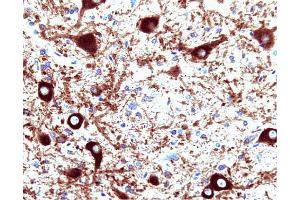 Dynamin (clone 41) staining on rat brain. (Dynamin 1 Antikörper  (AA 698-851))