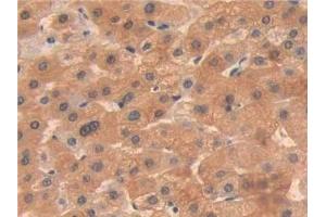 Immunohistochemistry (IHC) image for anti-Oncoprotein Induced Transcript 3 (OIT3) (AA 297-506) antibody (ABIN7434002)