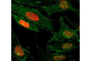ICC/IF test of HeLa cells treated with sodium butyrate using recombinant H3K4ac antibody (red). (Rekombinanter Histone 3 Antikörper  (acLys4))