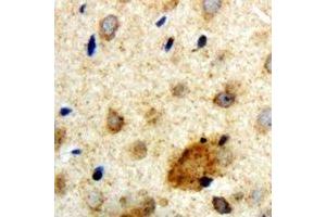 Immunohistochemical analysis of Clipin A staining in human brain formalin fixed paraffin embedded tissue section. (Coronin 1a Antikörper)