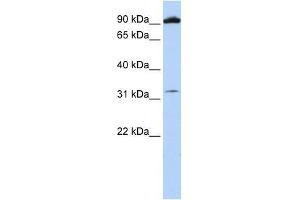 GRM6 antibody used at 0. (Metabotropic Glutamate Receptor 6 Antikörper  (N-Term))