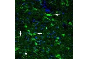Expression of Glucagon-like peptide 2 receptor in rat hypothalamus - Immunohistochemical staining of rat hypothalamus with Anti-GLP2R (extracellular) Antibody (ABIN7043221, ABIN7044408 and ABIN7044409), (1:200). (GLP2R Antikörper  (Extracellular))
