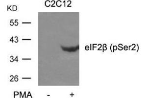 Western blot analysis of extracts from C2C12 cells untreated or treated with PMA using eIF2β (phospho-Ser2).