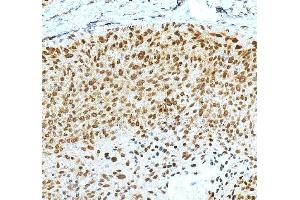 IHC analysis of KLF4 using anti-KLF4 antibody (ABIN7599343). (KLF4 Antikörper  (AA 1-389))