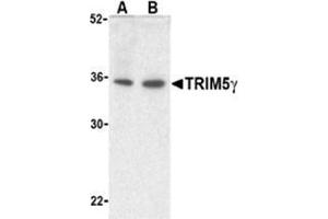 Western blot analysis of TRIM5 gamma expression in human bladder (A) and colon (B) cell lysate with TRIM5 gamma antibody at 2 μg /ml. (TRIM5 Antikörper  (C-Term, Isoform gamma))