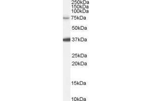 Western Blotting (WB) image for Neural Precursor Cell Expressed, Developmentally Down-Regulated 1 (NEDD1) peptide (ABIN369496)
