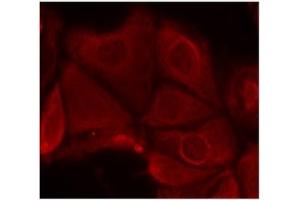 Image no. 3 for anti-Ribosomal Protein S6 Kinase, 70kDa, Polypeptide 1 (RPS6KB1) (pSer411) antibody (ABIN197035) (RPS6KB1 Antikörper  (pSer411))