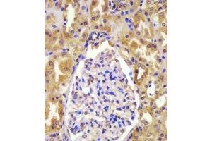 Immunohistochemistry (Paraffin-embedded Sections) (IHC (p)) image for anti-Von Hippel-Lindau Tumor Suppressor, E3 Ubiquitin Protein Ligase (VHL) (AA 43-71), (N-Term) antibody (ABIN390462)