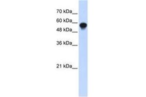 Image no. 1 for anti-Interferon Regulatory Factor 6 (IRF6) (C-Term) antibody (ABIN6742797) (IRF6 Antikörper  (C-Term))