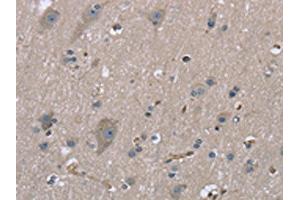 The image on the left is immunohistochemistry of paraffin-embedded Human brain tissue using ABIN7130317(MYL12B Antibody) at dilution 1/20, on the right is treated with fusion protein. (MYL12B Antikörper)