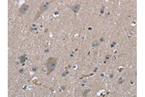 The image on the left is immunohistochemistry of paraffin-embedded Human brain tissue using ABIN7130317(MYL12B Antibody) at dilution 1/20, on the right is treated with fusion protein.