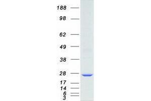 Validation with Western Blot (MAD2L1 Protein (Myc-DYKDDDDK Tag))