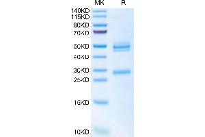 Mouse IL-12 on Tris-Bis PAGE under reduced condition. (IL12 Protein (AA 23-215) (His tag))