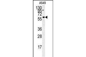 Western blot analysis in A549 cell line lysates (35ug/lane). (PARPBP Antikörper  (C-Term))