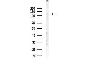 Western blot analysis of lysates from MDA-MB-231 cells, using Phospho-MORC2 (Ser615) Antibody at 1/1000 dilution.