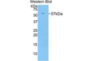 Western Blotting (WB) image for anti-Transglutaminase 1, Keratinocyte (TGM1) (AA 433-692) antibody (ABIN1860740)