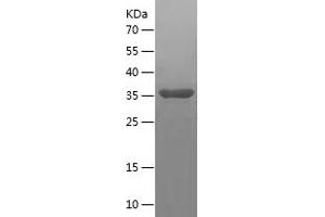 Western Blotting (WB) image for Cyclin-Dependent Kinase 2 Associated Protein 2 (CDK2AP2) (AA 1-126) protein (His-IF2DI Tag) (ABIN7283396) (CDK2AP2 Protein (AA 1-126) (His-IF2DI Tag))