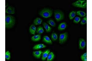 Immunofluorescent analysis of A549 cells using ABIN7171530 at dilution of 1:100 and Alexa Fluor 488-congugated AffiniPure Goat Anti-Rabbit IgG(H+L) (TAS1R2 Antikörper  (AA 183-362))