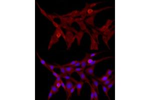 Immunofluorescence analysis of PC-12 cells using TRIM21/SS-A Rabbit pAb (ABIN3015761, ABIN3015762, ABIN3015763 and ABIN6219108) at dilution of 1:50 (40x lens). (TRIM21 Antikörper  (AA 80-330))