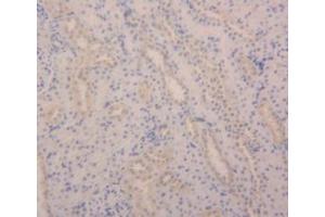 Detection of ANGPT2 in Rat Kidney Tissue using Polyclonal Antibody to Angiopoietin 2 (ANGPT2) (Angiopoietin 2 Antikörper  (AA 33-243))