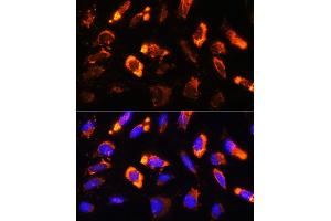 Immunofluorescence (IF) image for anti-Natriuretic Peptides B (NPPB) (AA 1-134) antibody (ABIN3023136)