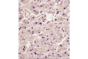 (ABIN6242410 and ABIN6578870) staining IL1R in human liver tissue sections by Immunohistochemistry (IHC-P - paraformaldehyde-fixed, paraffin-embedded sections). (IL1RAP Antikörper  (AA 484-518))