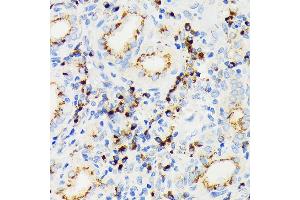 Immunohistochemistry (IHC) image for anti-Eukaryotic Translation Initiation Factor 2A, 65kDa (EIF2A) antibody (ABIN7267035)