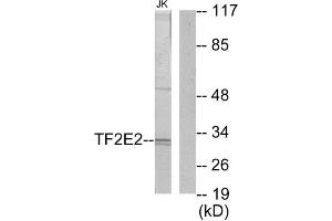 Western Blotting (WB) image for anti-General Transcription Factor IIE, Polypeptide 2 (GTF2E2) (Internal Region) antibody (ABIN1849294) (GTF2E2 Antikörper  (Internal Region))