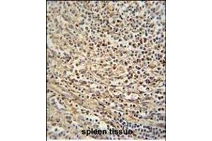 GSDMC antibody (Center) (ABIN654726 and ABIN2844414) immunohistochemistry analysis in formalin fixed and paraffin embedded human spleen tissue followed by peroxidase conjugation of the secondary antibody and DAB staining. (MLZE Antikörper  (AA 218-246))