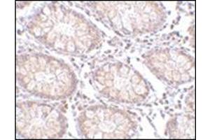 Immunohistochemistry of PTK7 in human colon tissue with this product at 5 μg/ml. (PTK7 Antikörper  (N-Term))