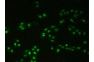 Detection of XRCC5 in Human Hela Cells using Polyclonal Antibody to X-Ray Repair Cross Complementing 5 (XRCC5) (X-Ray Repair Cross Complementing 5 (AA 251-732) Antikörper)