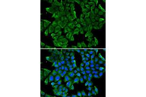 Immunofluorescence analysis of MCF-7 cell using REG3G antibody. (REG3g Antikörper)