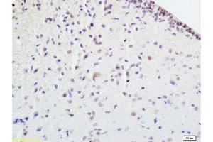 Formalin-fixed and paraffin embedded rat brain tissue labeled withAnti-EPOR Polyclonal Antibody , Unconjugated at 1:100 followed by conjugation to the secondary antibody, (SP-0023), and DAB staining (EPOR Antikörper  (AA 301-450))